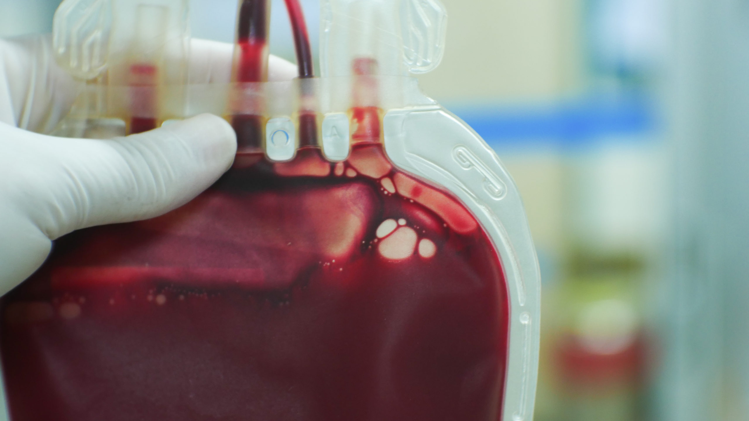 Blood centers across nation report critical shortages