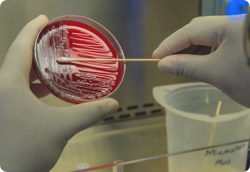 Gloved Hands performing blood testing with petri dish