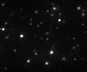 Extracellular vesicles BBG Advanced Therapies